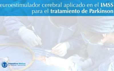 Neuroestimulador cerebral aplicado en IMSS para tratamiento de Parkinson