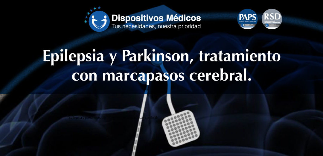 Epilepsia y parkinson, tratamiento con marcapasos cerebral.