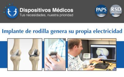 Implante de rodilla genera su propia electricidad.