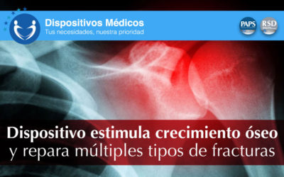 Dispositivo estimula crecimiento óseo y repara múltiples tipos de fracturas.