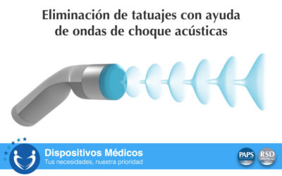 Eliminación de tatuajes con ayuda de ondas de choque acústicas.