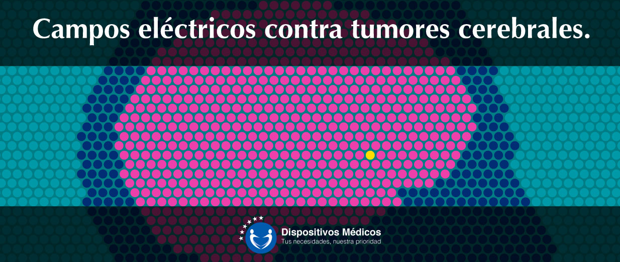 Campos eléctricos contra tumores cerebrales.