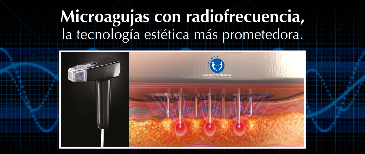 Microagujas con radiofrecuencia, la tecnología estética más prometedora.