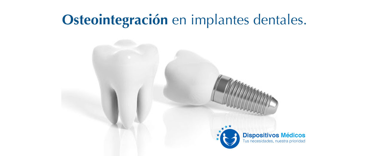 Osteointegración en implantes dentales.