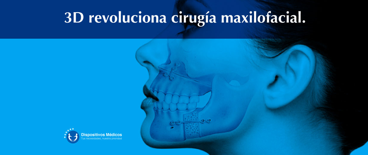 3D revoluciona cirugía maxilofacial.