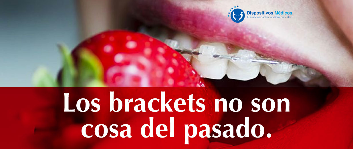 Los brackets no son cosa del pasado.