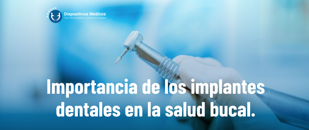 Importancia de los implantes dentales en la salud bucal.