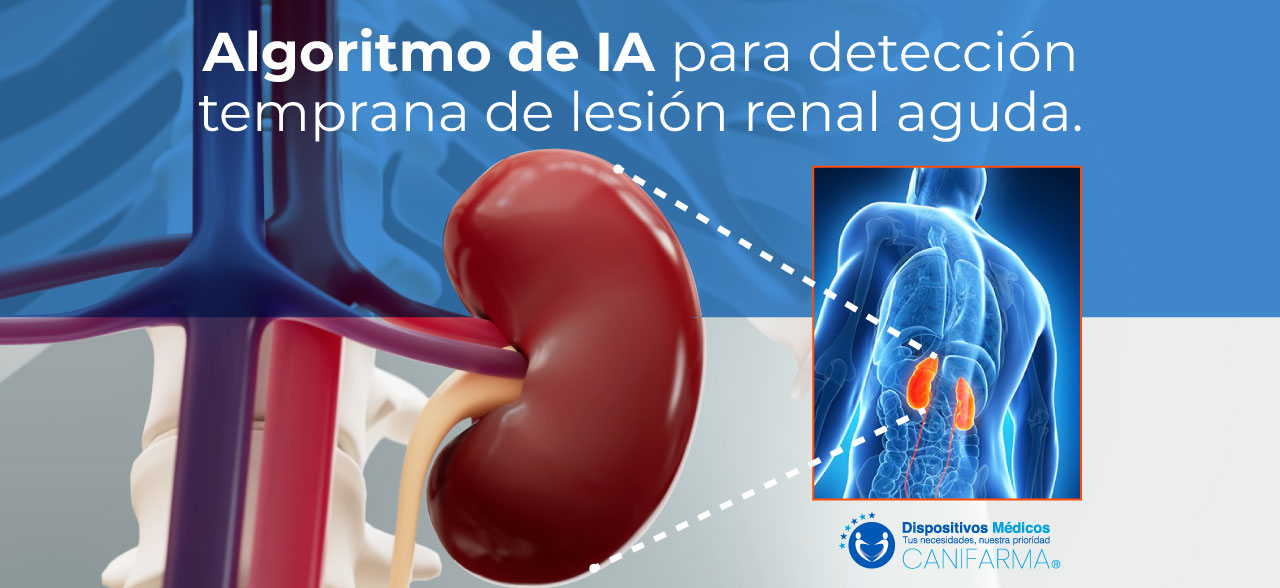Algoritmo de IA para detección temprana de lesión renal aguda.