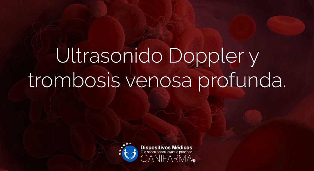 Ultrasonido Doppler y trombosis venosa profunda.