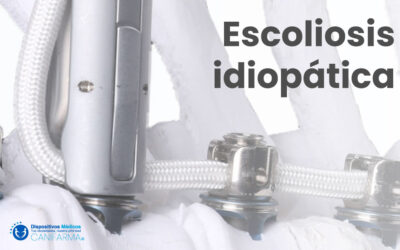 Escoliosis idiopática.