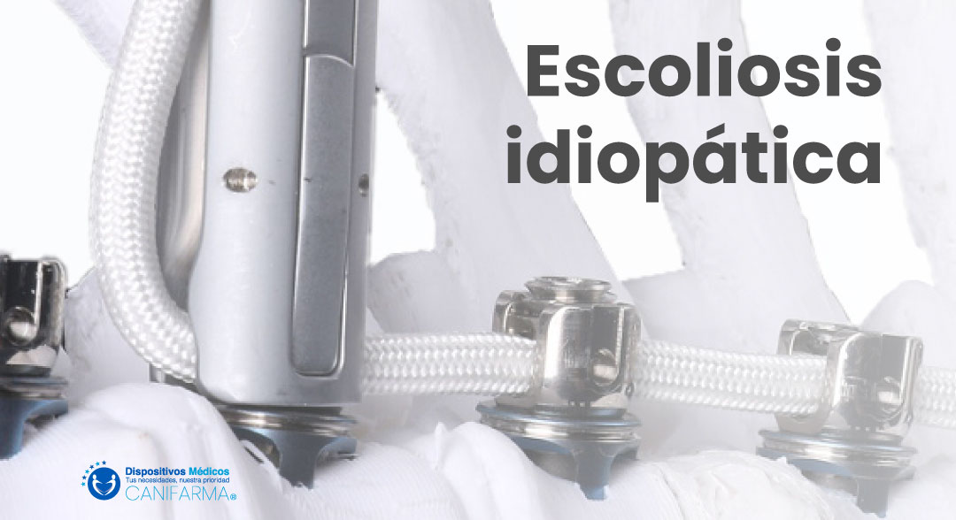 Escoliosis idiopática.