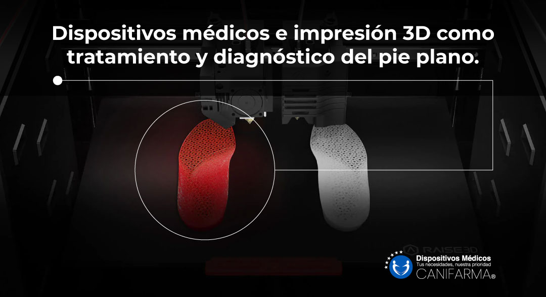 Dispositivos médicos e impresión 3D como tratamiento y diagnóstico del pie plano.