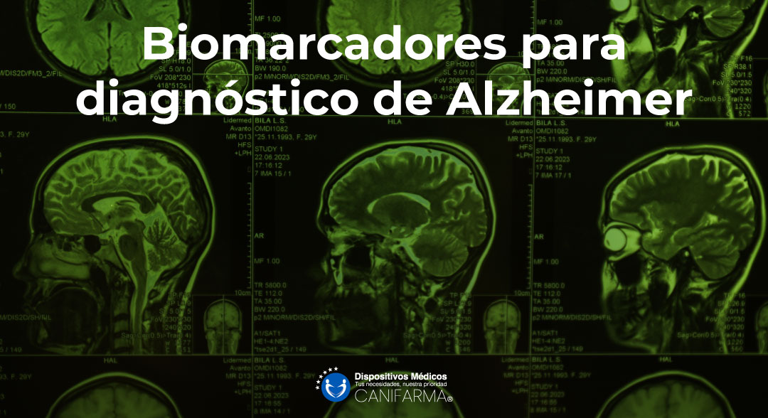 BiomarcadoresAlzheimer