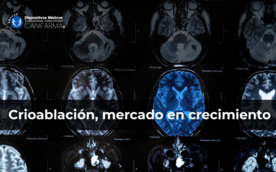 Crioablación, mercado en crecimiento