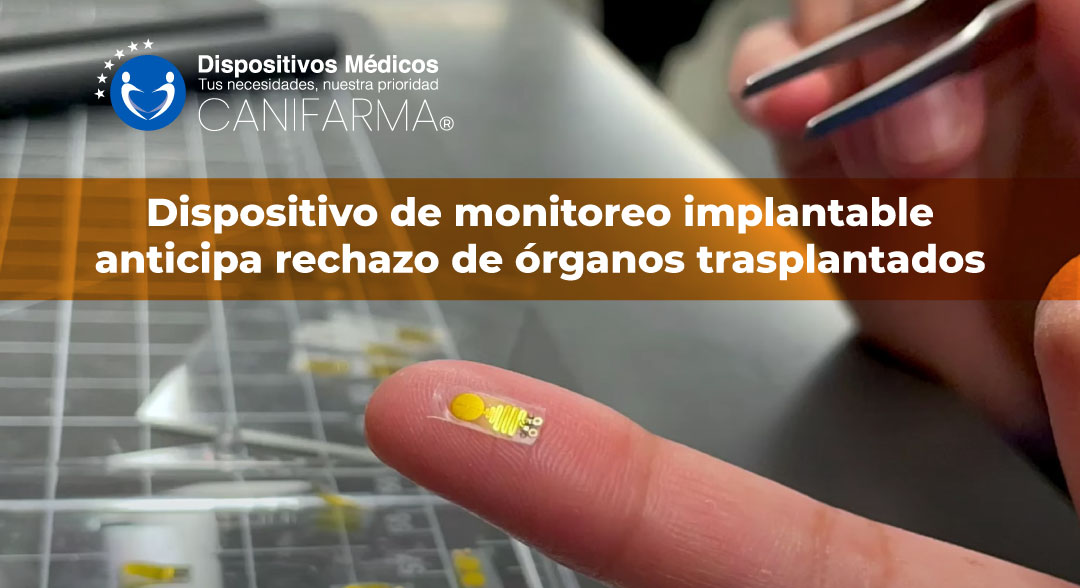 DispositivoMonitoreoAnticipaRechazoTransplantes