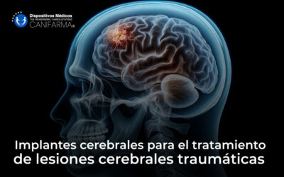 Implantes cerebrales para el tratamiento de lesiones cerebrales traumáticas