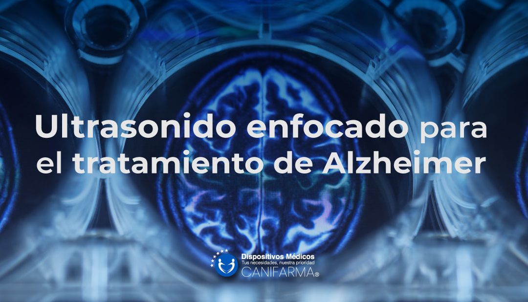 FUSparaAlzheimer