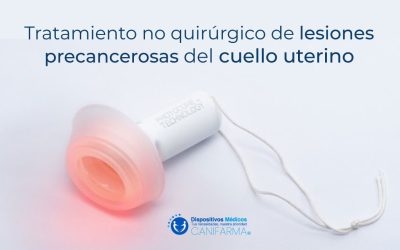 Tratamiento no quirúrgico de lesiones precancerosas del cuello uterino