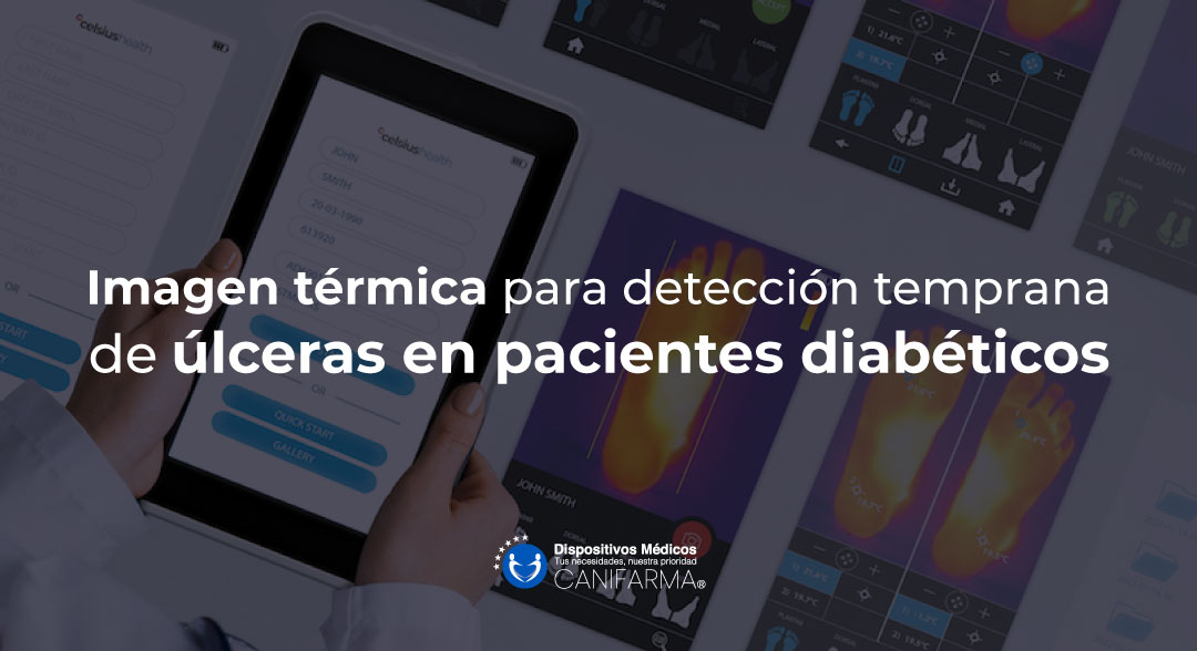 Imagen térmica para detección temprana de úlceras en pacientes diabéticos