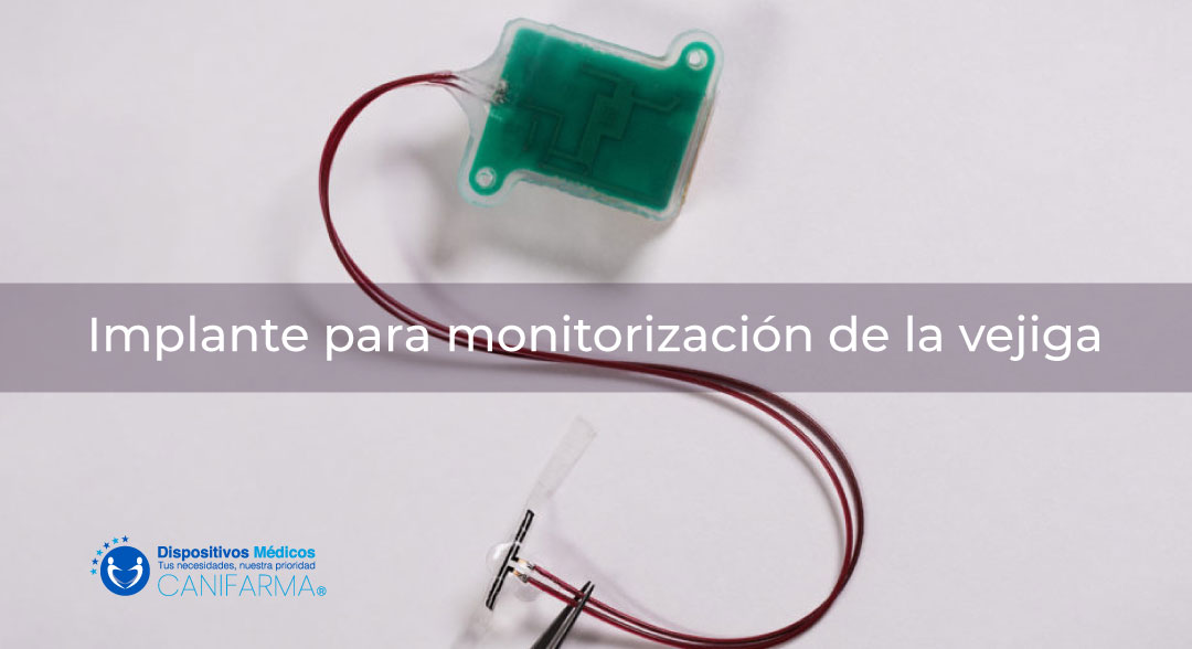Implanteparamonitorizaciondelavejiga