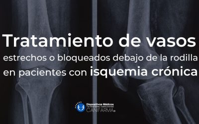 Tratamiento de vasos estrechos o bloqueados debajo de la rodilla en pacientes con isquemia crónica