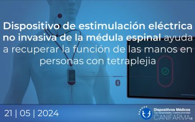 Dispositivo de estimulación eléctrica no invasiva de la médula espinal ayuda a recuperar la función de las manos en personas con tetraplejia