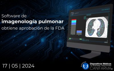 Software de imagenología pulmonar obtiene aprobación de la FDA