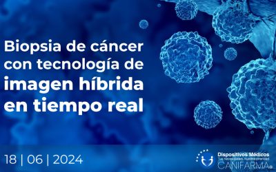 Biopsia de cáncer con tecnología de imagen híbrida en tiempo real