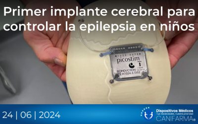 Primer implante cerebral para controlar la epilepsia en niños