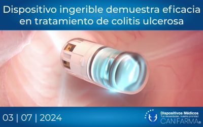 Dispositivo ingerible demuestra eficacia en tratamiento de colitis ulcerosa