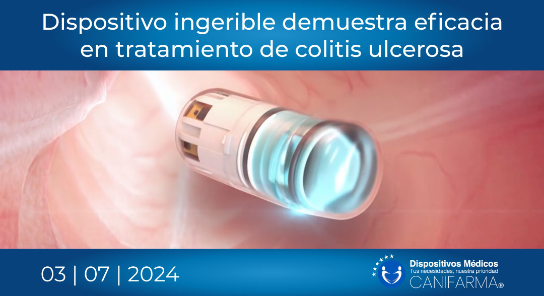 DispositivoIngeribleparaColitisUlcerosa