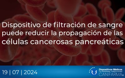 Dispositivo de filtración de sangre puede reducir la propagación de las células cancerosas pancreáticas