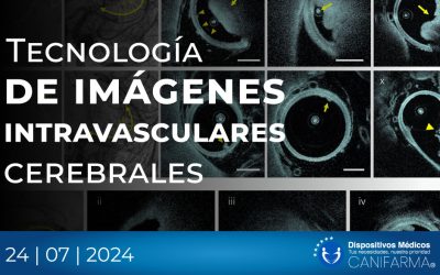 Tecnología de imágenes intravasculares cerebrales