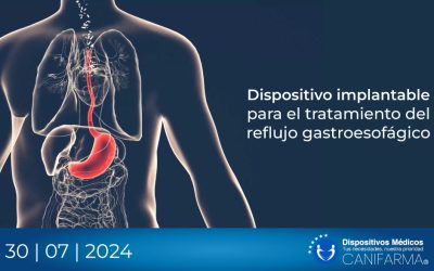 Dispositivo implantable para el tratamiento del reflujo gastroesofágico