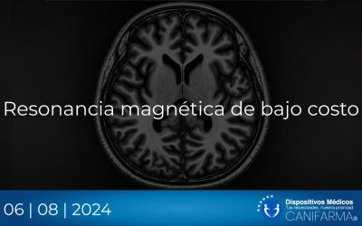 Resonancia magnética de bajo costo