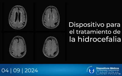 Dispositivo para el tratamiento de la hidrocefalia