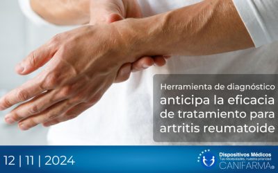 Herramienta de diagnóstico anticipa la eficacia de tratamiento para artritis reumatoide