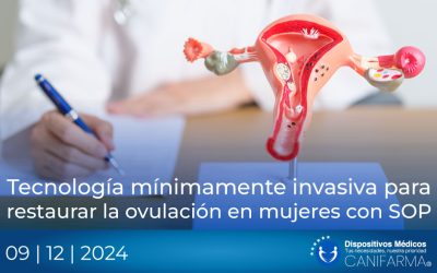 Tecnología mínimamente invasiva para restaurar la ovulación en mujeres con SOP