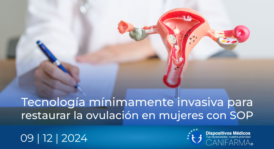 Tecnología mínimamente invasiva para restaurar la ovulación en mujeres con SOP