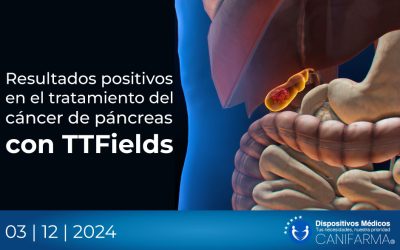 Resultados positivos en el tratamiento del cáncer de páncreas con TTFields