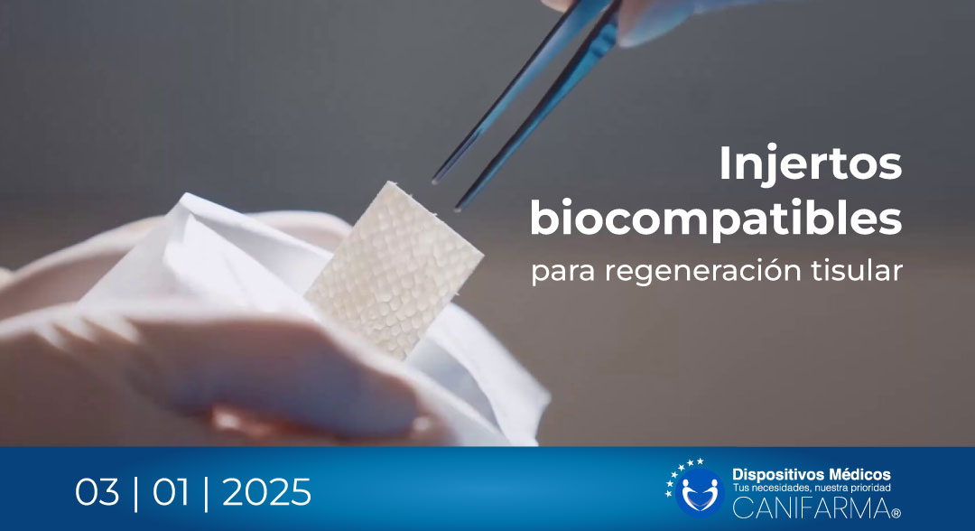 Injertos biocompatibles para regeneración tisular