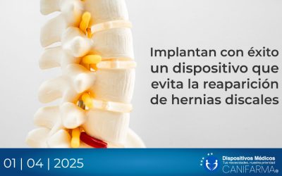 Implantan con éxito un dispositivo que evita la reaparición de hernias discales
