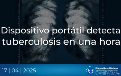 Dispositivo portátil detecta tuberculosis en una hora