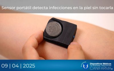 Sensor portátil detecta infecciones en la piel sin tocarla