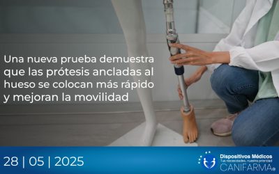 Una nueva prueba demuestra que las prótesis ancladas al hueso se colocan más rápido y mejoran la movilidad