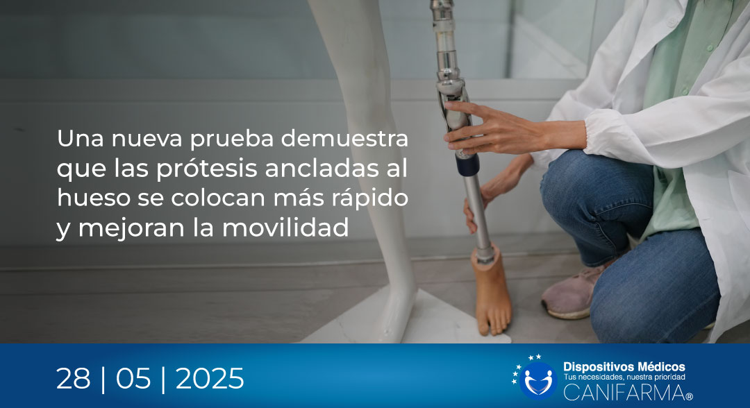 Una nueva prueba demuestra que las prótesis ancladas al hueso se colocan más rápido y mejoran la movilidad BoneAnchoredProsthesis