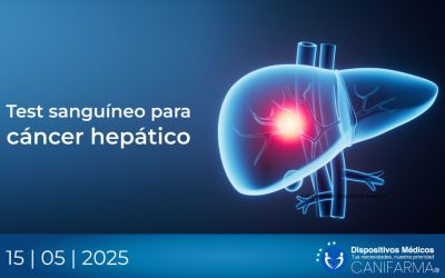Test sanguíneo para cáncer hepático