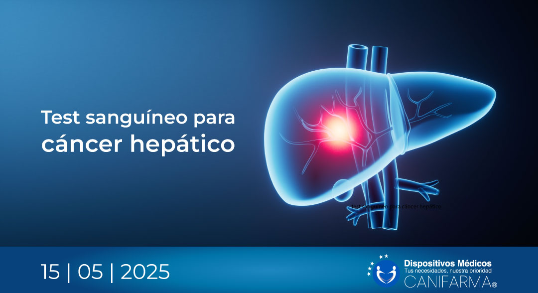 Test sanguíneo para cáncer hepático
