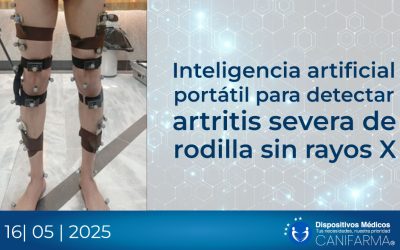 Inteligencia artificial portátil para detectar artritis severa de rodilla sin rayos X