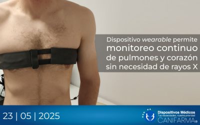 Dispositivo wearable permite monitoreo continuo de pulmones y corazón sin necesidad de rayos X